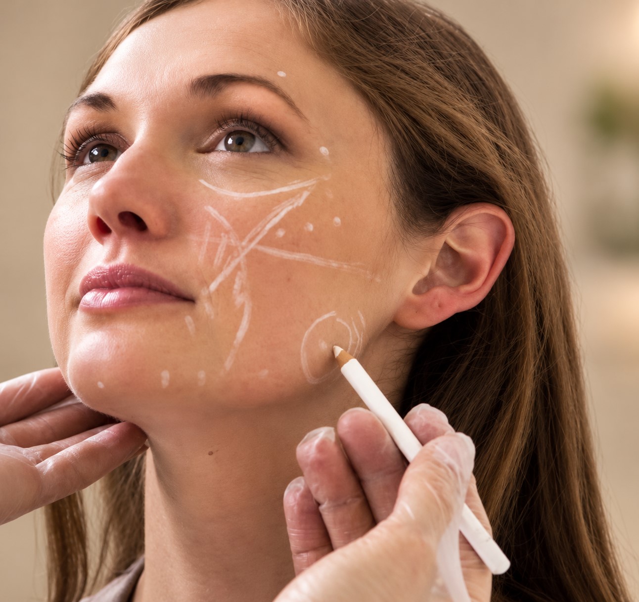 Cheek Augmentation